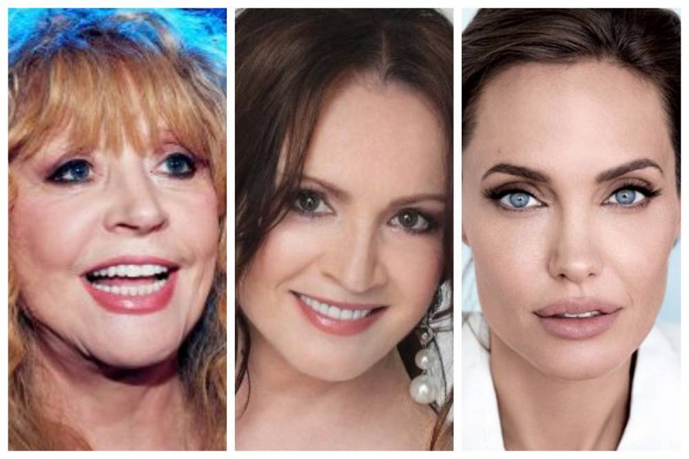 Пугачева, Ротару, Анджелина Джоли и другие звезды, которые "перекроили" свои лица: топ интересных фото