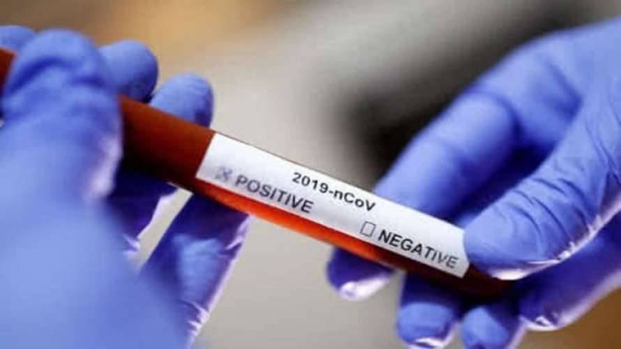 В Запорожье выявили наибольшее количество заболевших коронавирусом