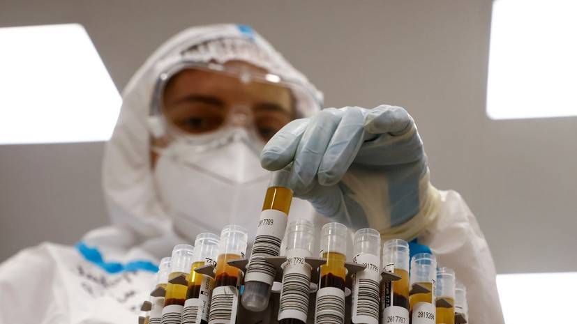 В Удмуртии выявлено 190 случаев коронавируса за сутки