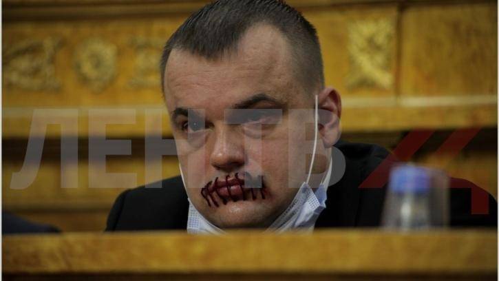 Депутат Заксобрания Ленинградской области пришел на заседание с «зашитым» ртом