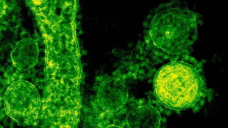 Роспотребнадзор заявил о возможных ложноотрицательных результатах теста на коронавирус