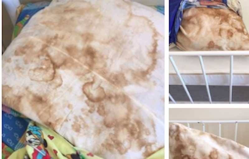 «Пусть чиновникам будет стыдно!»: россиянин показал жуткие подушки в детской больнице