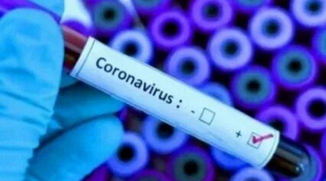 На Украине почти закончили разработку системы обнаружения коронавируса