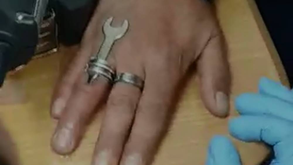 Видео: жителя Беэр-Шевы спасли от застрявшего на пальце кольца специнструментом