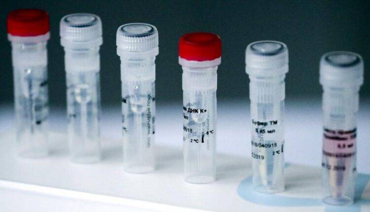 Попова заявила об эффективности российских тест-систем на коронавирус