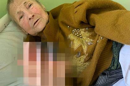 Российская пенсионерка обморозила руки в собственном доме