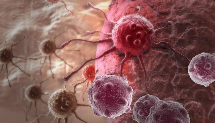 Немецкий исследователь назвал эффективный способ борьбы с раком