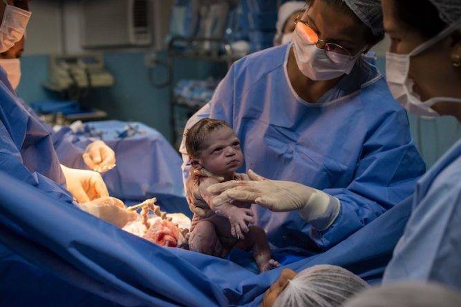 Новорожденная «угрюмо» посмотрела на врача после появления на свет. Ее фото стало вирусным