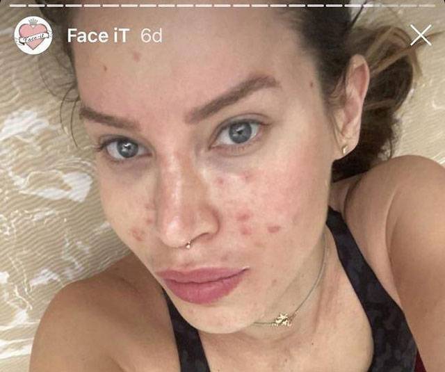 Израильская манекенщица Натали Дадон взорвала соцсети своим фото без макияжа