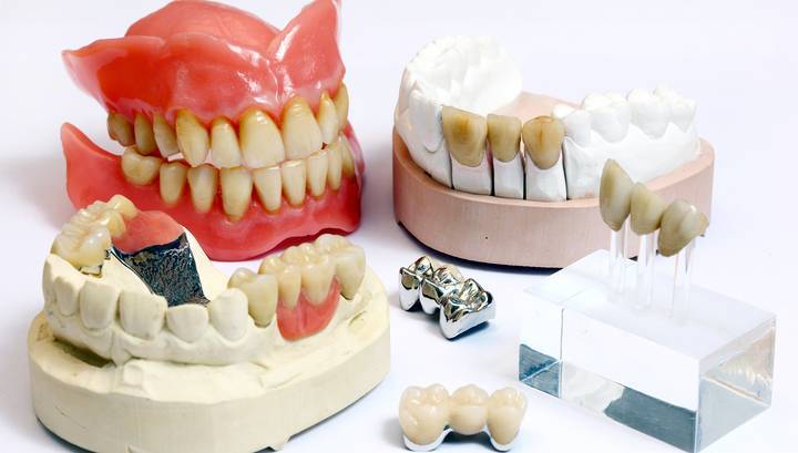 Зубные коронки из разных материалов могут стать причиной рака