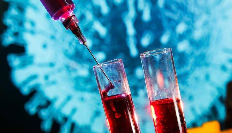 Российский эксперт допустил искусственное происхождение коронавируса