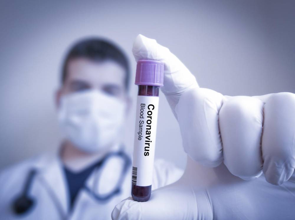 Первый американец умер от коронавируса. Мировая автопромышленность под угрозой остановки
