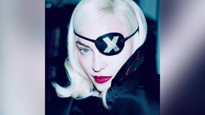 После падения на концерте в Париже Мадонна разрыдалась от боли
