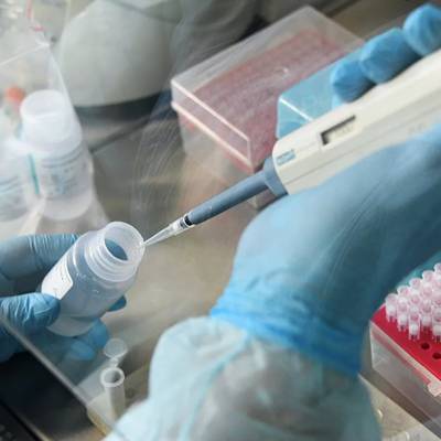 Россия передала 800 тест-систем для диагностики коронавируса странам ЕАЭС
