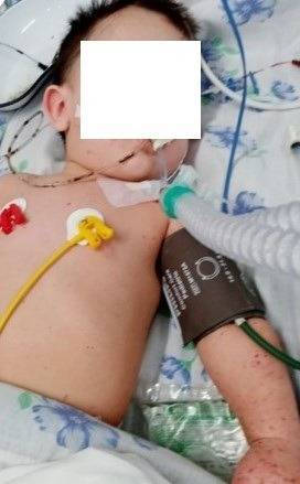 В Екатеринбурге от менингококка скончался полуторалетний ребенок. СКР ведет проверку