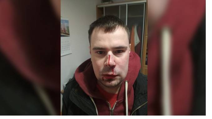 После нападения на лидера петербургского отделения "Другой России" возбуждено уголовное дело
