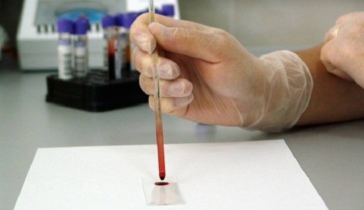 В Госдуме предлагают продавать тесты на ВИЧ в аптеках