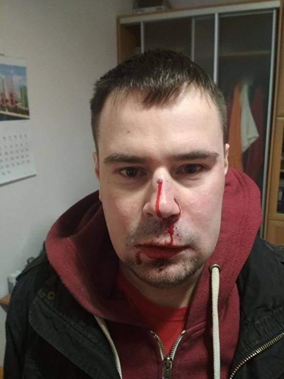 Полиция Петербурга возбудила дело по факту избиения лидера местной «Другой России»