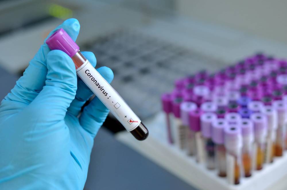 В Нидерландах ученые обнаружили антитело против коронавируса - Cursorinfo: главные новости Израиля
