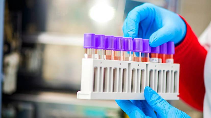 РФПИ инвестирует в производство тестов на коронавирус