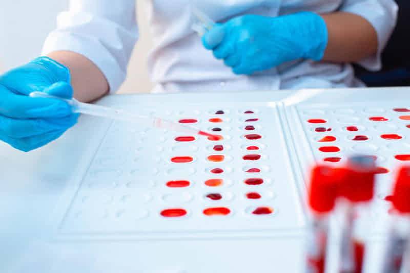 Ученые узнали, какая группа крови больше подвержена коронавирусу - Cursorinfo: главные новости Израиля