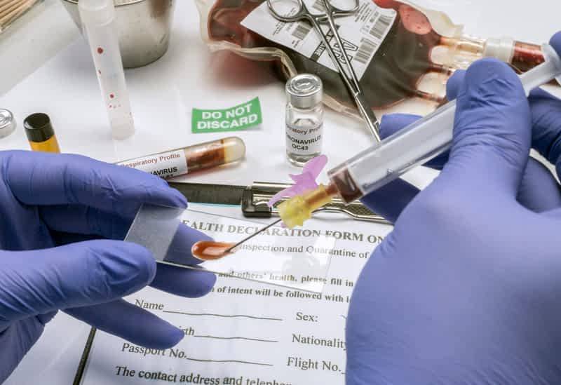Ученые нашли слабое место коронавируса - Cursorinfo: главные новости Израиля