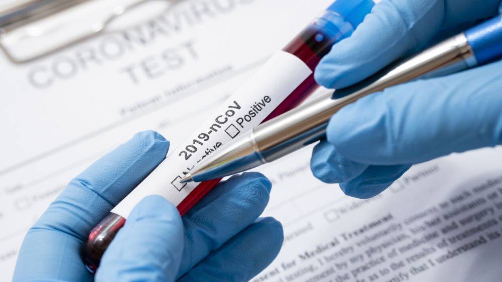 В Петербурге обновили список пунктов, где можно сдать тест на коронавирус