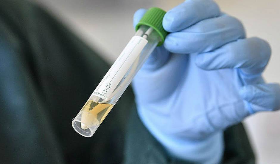 Власти Москвы заказали тесты на коронавирус у неизвестной фирмы без телефона и сайта
