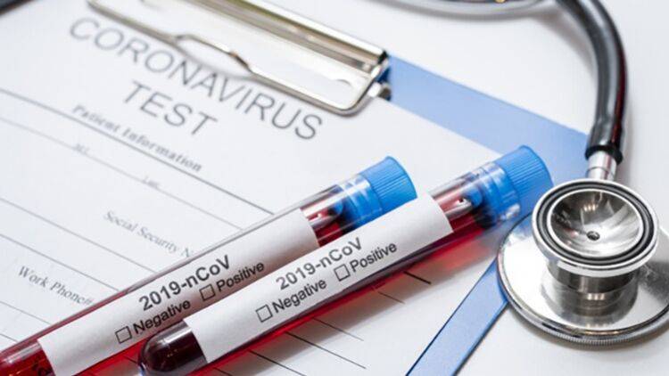 Первичные анализы выявили новый коронавирус у пяти человек в Якутии