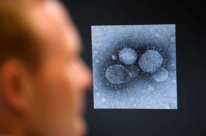 Российские ученые показали коронавирус под микроскопом