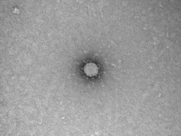 Российские ученые показали "фото" коронавируса