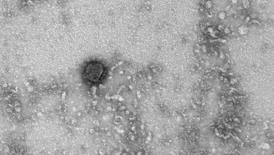 Российские ученые показали, как выглядит коронавирус под микроскопом