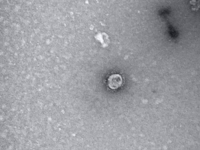 Российские ученые показали первые фото коронавируса