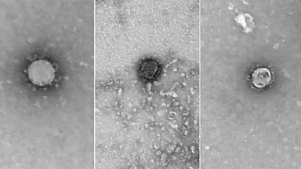 Открытый доступ к геному коронавируса назвали бессмысленным для террористов