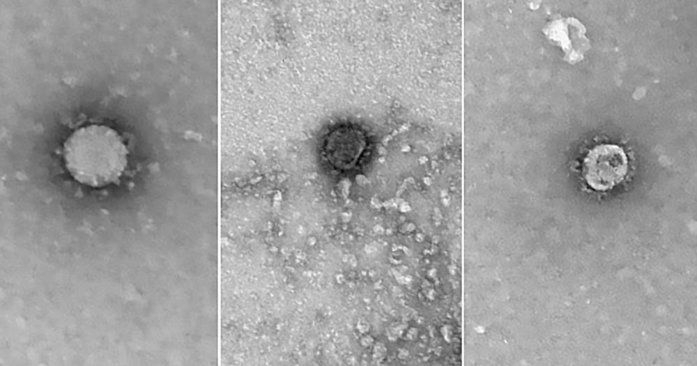 Ученые рассказали, откуда взялся новый коронавирус