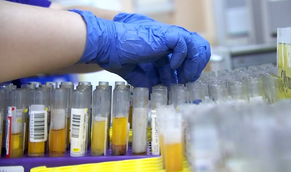 Собянин: "В Москве будут проводить 10 000 тестов на коронавирус в сутки"
