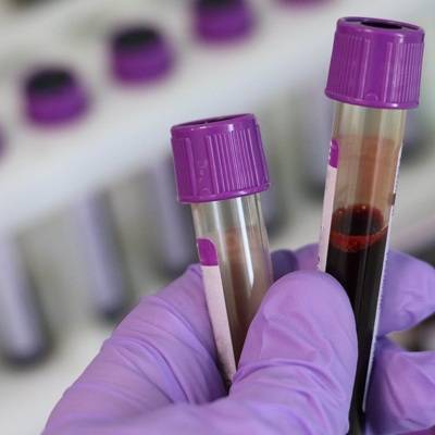 Роспотребнадзор передал тест-системы для определения коронавируса в 13 стран
