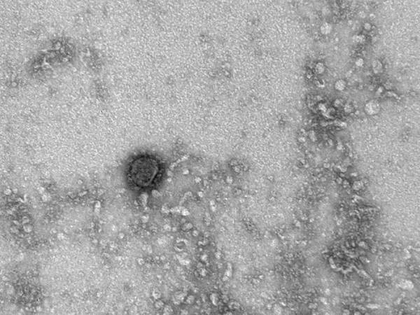 Количество заболевших коронавирусом в Подмосковье увеличилось до 35