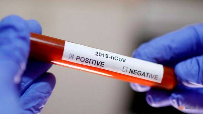 В Сингапуре создан экспресс-тест на коронавирус