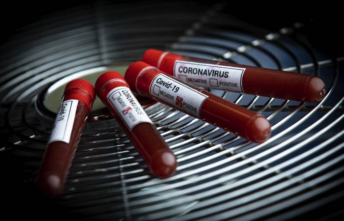 Правительство выделило 1,4 млрд рублей на разработку средств диагностики коронавируса