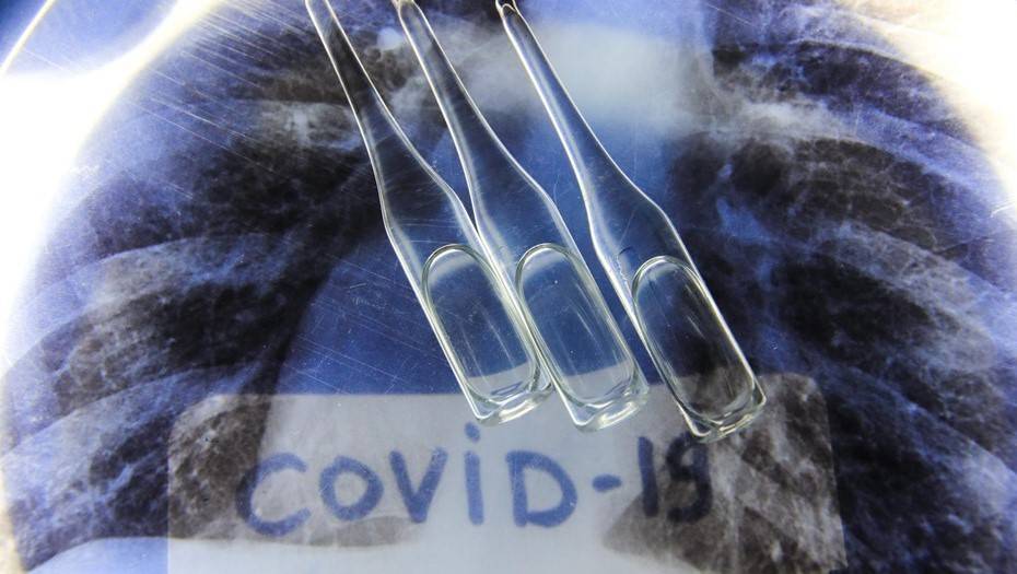 Лаборатории в Москве и Петербурге начнут тестировать на коронавирус COVID-19