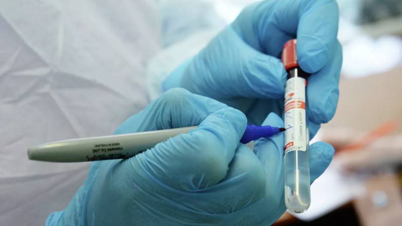 В Новосибирске зарегистрировали новую тест-систему на коронавирус