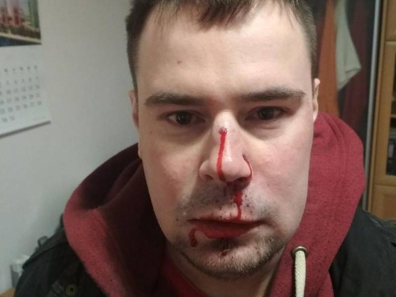 Руководителя "Другой России" в Петербурге избили в подъезде собственного дома