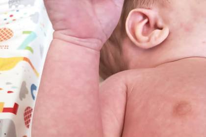 Мать зараженного коронавирусом младенца перечислила симптомы болезни