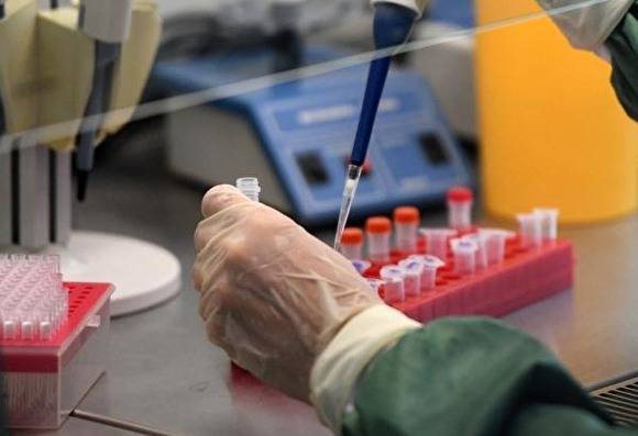 Ученые Роспотребнадзора создали высокоточный тест для диагноза коронавируса
