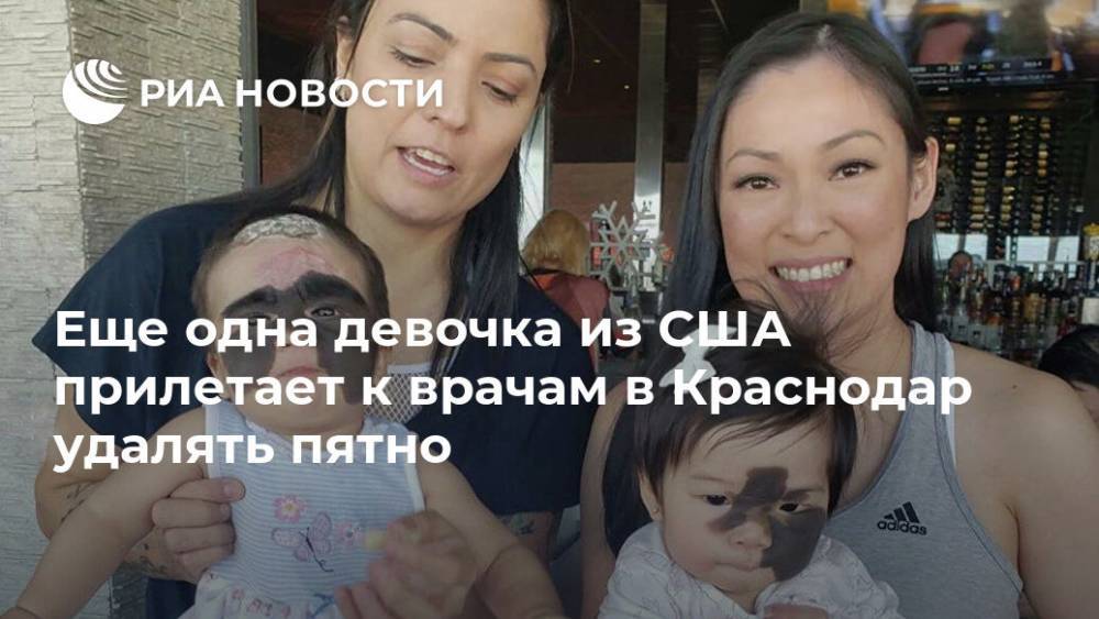 Еще одна девочка из США прилетает к врачам в Краснодар удалять пятно
