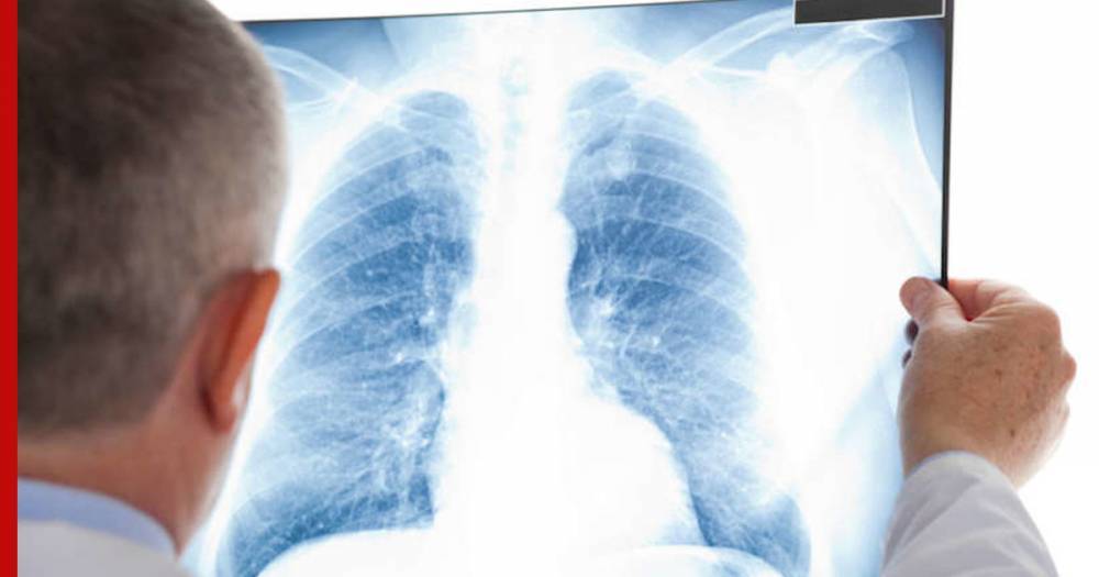 Медики посоветовали некурящим людям провериться на рак легких
