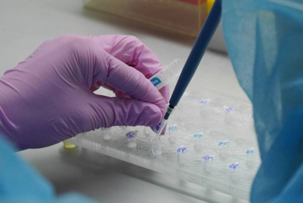 В США заявили о дефиците тестов на коронавирус - Cursorinfo: главные новости Израиля