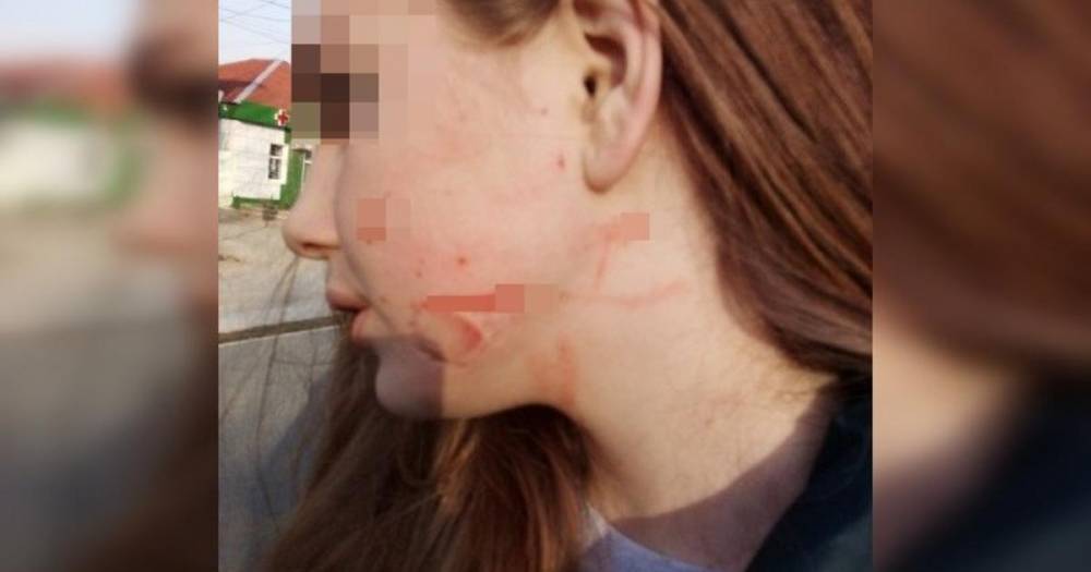 Видео: Женщина жестоко избила 13-летнюю девочку на улице под Ростовом