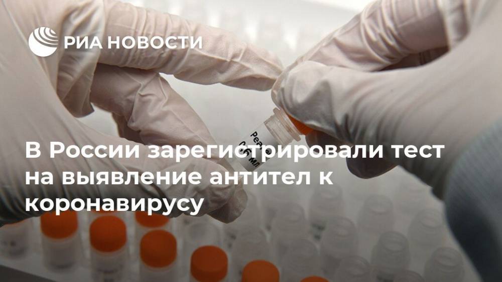 В России зарегистрировали тест на выявление антител к коронавирусу